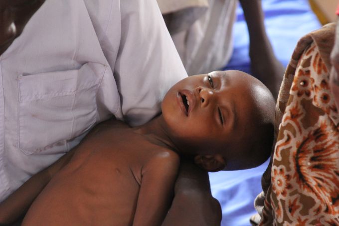 nigeria-maiduguri-malnutrition